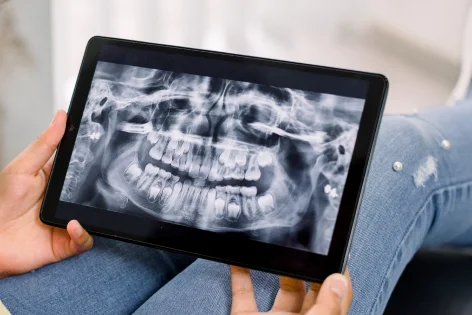Digital X-Rays