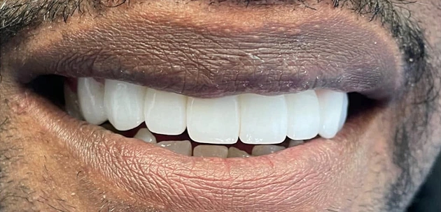 teeth dental treatment After
