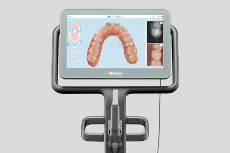 iTero Digital Scanner
